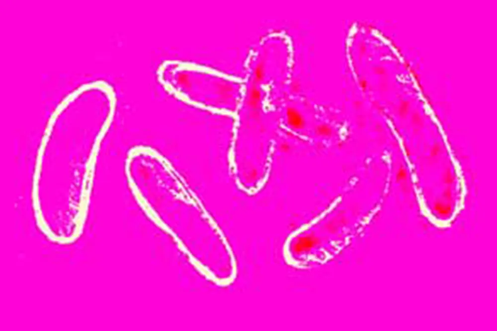 Legionella Fatality